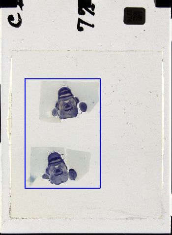 Media type: image; Special Collections 3298   shows specimen_part histological serial section;